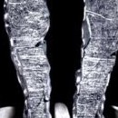Affiche teaser