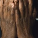 D.R.