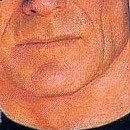 D.R.