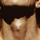 D.R.