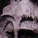 D.R.