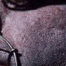 D.R.