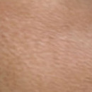 DR