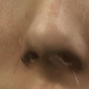 DR