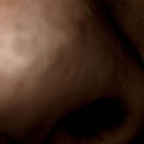 DR