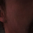 DR