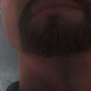 DR