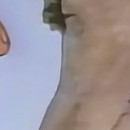 DR