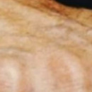 DR