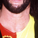 DR