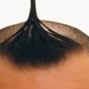 DR