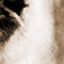 DR