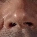 DR