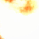 DR