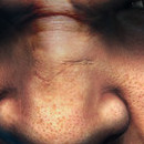 DR