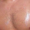 DR