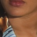 DR