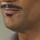 DR