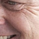DR