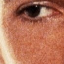 DR