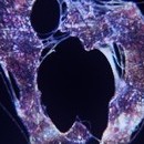 DR