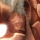 DR